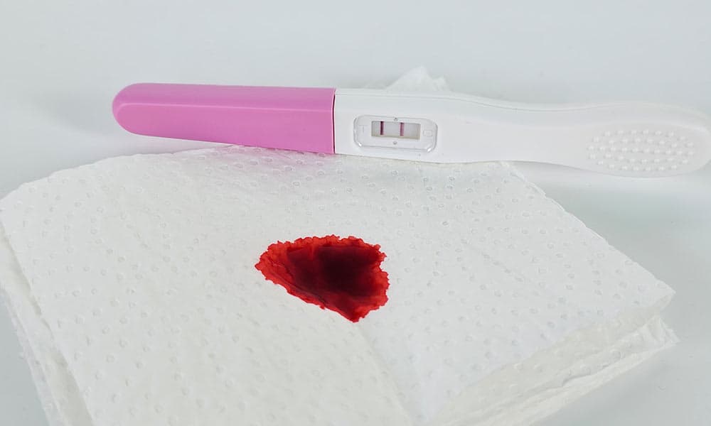 Bleeding During Pregnancy? Here’s Why It’s Not Your Period