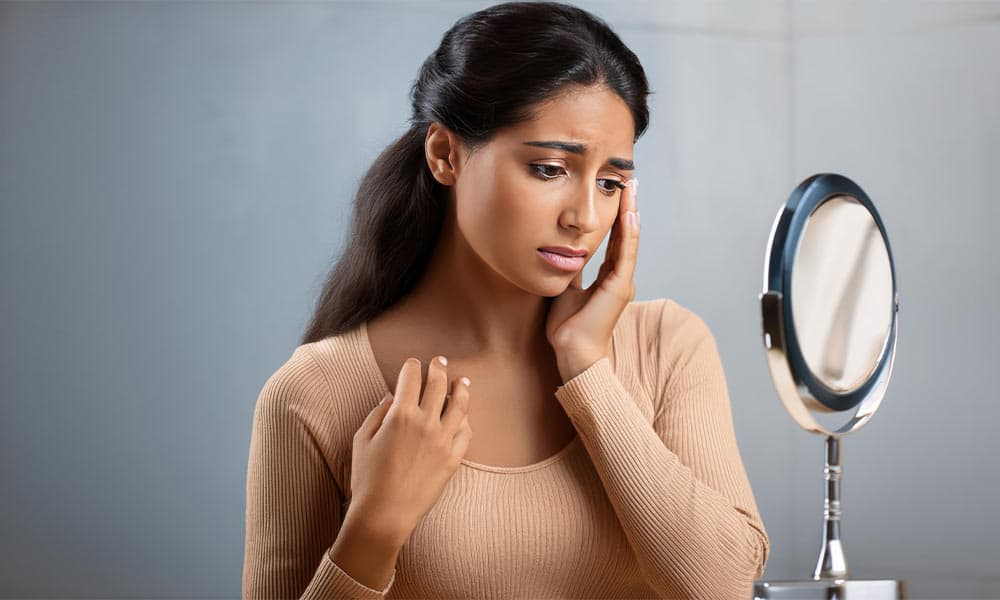 Period Acne: Why You Get It and How to Prevent Acne Before Your Period Naturally