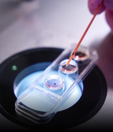 Artificial Insemination