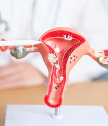 IUI Treatment