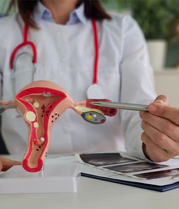 Ovarian Cysts