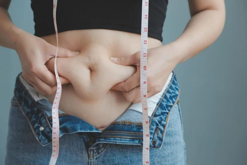 PCOS belly