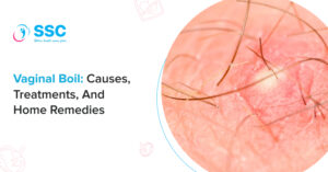 Vaginal Boil: Pictures, Causes, Treatments, and Home Remedies