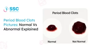 Period Blood Clot Pictures