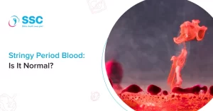 String period blood pictures